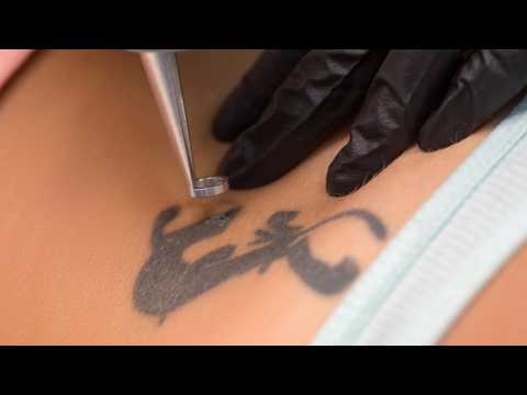 AMI Picolegend High Powered Picosecond Laser for Tattoos, Pigmentation & Skin Rejuvenation