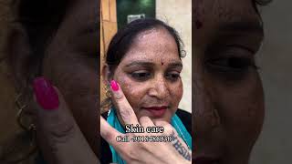 Skin care 9818485930 #facetreatment #faceglow #facebrightening #skincare #viral #nishalambha