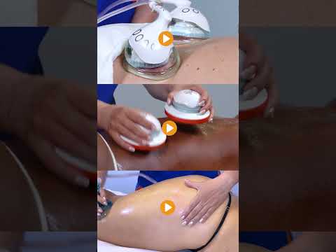 Professional 8-in-1 Vacuum Therapy Machine | Deluxe Pro Delfín #vacuumtherapy #bodysculptingmachine