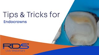Tips and tricks for Endo-crowns