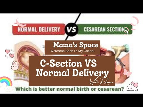 C-section VS Normal Delivery #CSection #NormalDelivery #ChildbirthChoices #PregnancyJourney #fyp