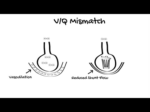 Inhaled Nitric Oxide in ICU