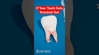 If Your Tooth Gets Knocked Out:  How to Save It Before It's Too Late 🦷 #medical #medicalstudent