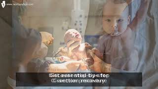 Top 5 Essential C-Section Tips: Prep, Procedure & Recovery