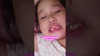 HER TOOTH FELL OFF AGAIN #preschooler #cute #toothfallout