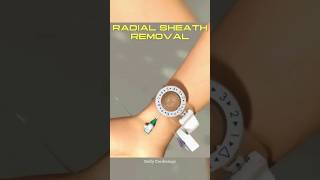 Radial sheath REMOVAL after PCI !! #cardiology #pci #heart #shorts