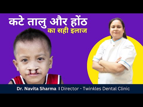 ✅Cleft Palate Ka Sahi Ilaaj I ✅ Cleft Palate Ke Liye Sabse Achi Surgery I Dr. Navita