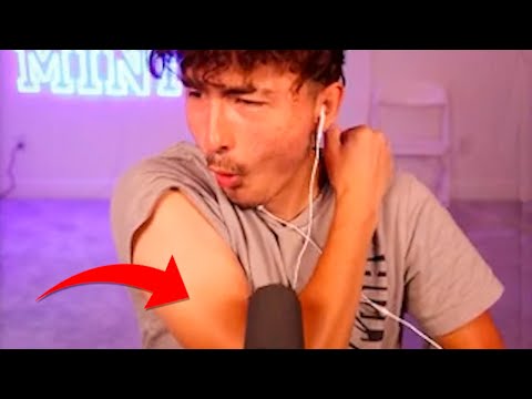 MINI Got SUNBURN!