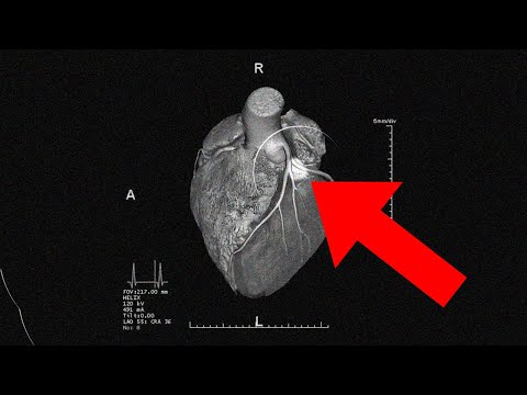 God's Revelation (to the) Human Heart
