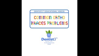 Various Common Orthodontic Braces Problems