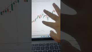 Candlestick pattern क्या होता है📊 Candlestick pattern analysis Trader Kaur | #candlestick