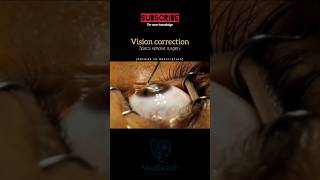Vision Correction Surgery | Say Goodbye to Specs! 👓✨ #youtubeshorts #healthshorts #medicalshorts