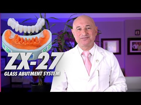 ZX-27 Glass Abutment System