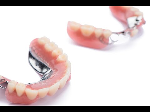 Part of the Process - Electropolishing Metal Partials - Metal Partial Dentures at Utica Dental Lab