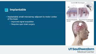 Brain Computer Interface in Patients with ALS