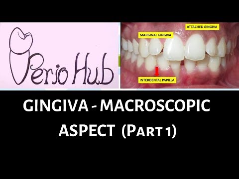 GINGIVA - Marginal/ Free gingiva