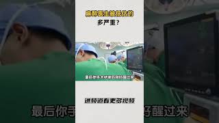 麻醉医生被低估的多严重？#知识 #趣闻 #历史