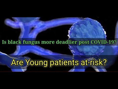 Is black fungus more deadlier post COVID-19?Are younger patients more at risk?|COVID-19|Mucormycosis