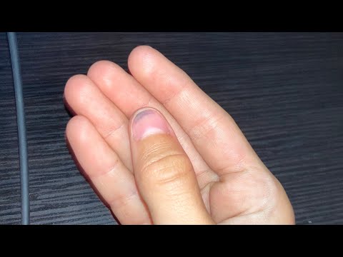 I almost broke my thumb to hit this clip... #shorts
