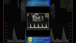 NT Scan in Pregnancy Explained | When & Why It’s Done | Dr. K. Sree Lalitha | HCC Hospital Mydukur