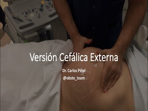 External Cephalic Version - Dr. Piñel