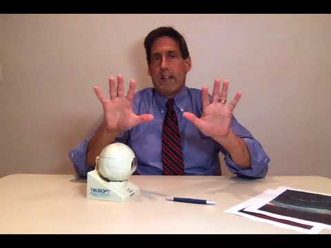 Pseudoexfoliation syndrome | Dr. Alan Mendelsohn
