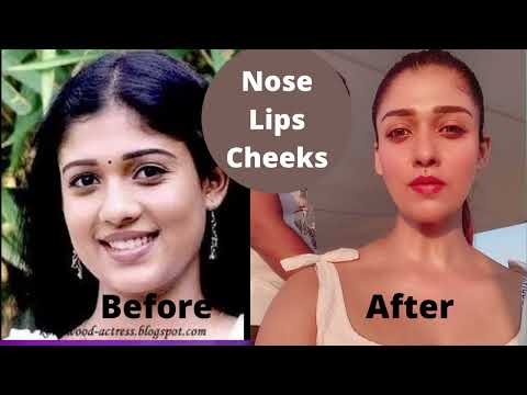 Plastic surgery before and after pics| Tamannah| Nayanthara | Kajal | Aditi Rao