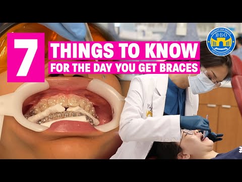 7 Things to Know for the Day You Get Braces