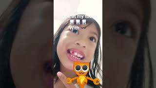 my tooth fall out