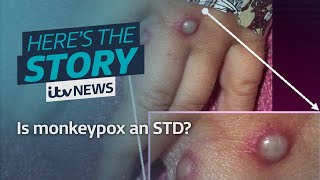 Is monkeypox an STD? | ITV News