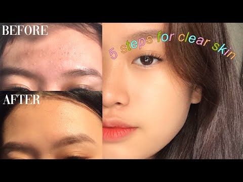 MY 5 BASIC STEPS FOR CLEAR SKIN 🍃✨ (Philippines)