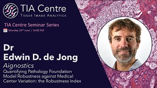 Quantifying Foundation Model Robustness: the Robustness Index: Edwin de Jong, 23/06/25
