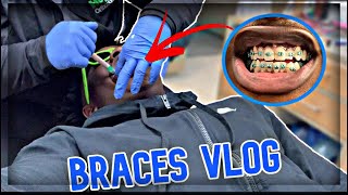 GRWM: Getting Braces Vlog (2021)
