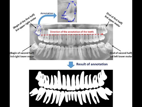 SIBGRAPI 2020 - A study on tooth segmentation and numbering using end to end deep neural networks