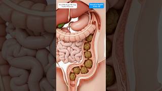Realistic Colon Animation of Compacted Stool Moving With Intestinal Peristalsis #motivation #shorts