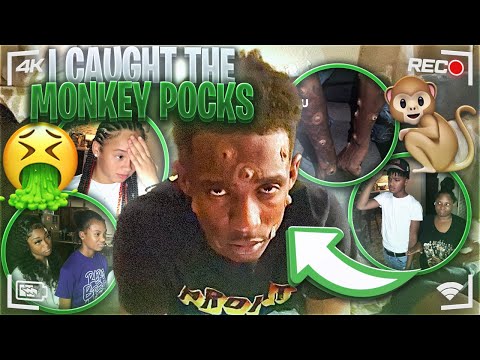 TELLING THE KIDS I HAVE MONKEY POXS🐒TO SEE THEIR REACTION😱 (they started crying)💔 #baebaekids