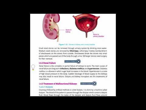 Malfunctioning of Kidneys: Renal Failure in Urdu