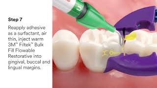 Bioclear™ Class II Restorations Video