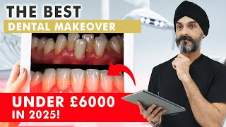 The BEST Cosmetic Dental Treatments Under £6000! Full Breakdown