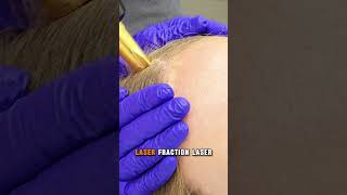 #AMWC2025 #HairRestoration #DrMaxChumak #MedicalExcellence #MonacoConference #HairRestorationSurgeon