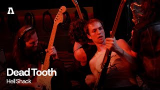 Dead Tooth - Hell Shack | Audiotree Live