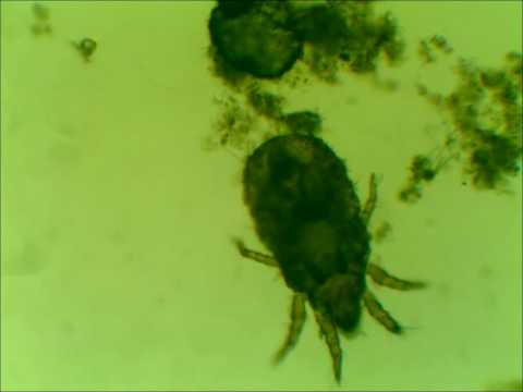 House Mites under Microscope take 2
