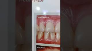 see the difference?#dentaladvice#shorts