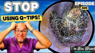STOP Using Q-Tips! Episode 505