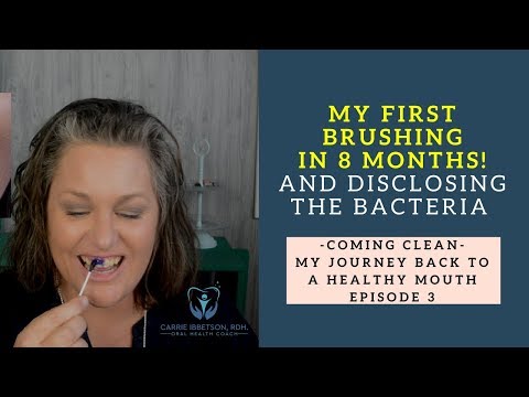 My First Brushing in 8 MONTHS and Disclosing the Bacteria to See It | Episode 3 Coming Clean
