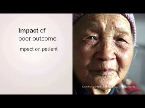 Global Blindness course: Managing cataract outcome