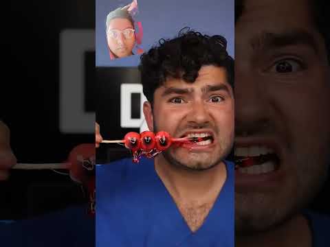 #food #teeth #candy #mukbang #drteeth #challenge #teeths #unboxing #crowdedteeth #tiny