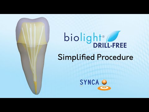 Biolight Drill-Free simplified procedure