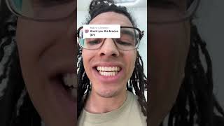 Are you the braces guy?