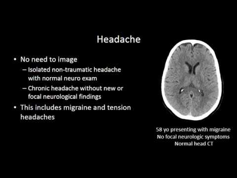 Headache